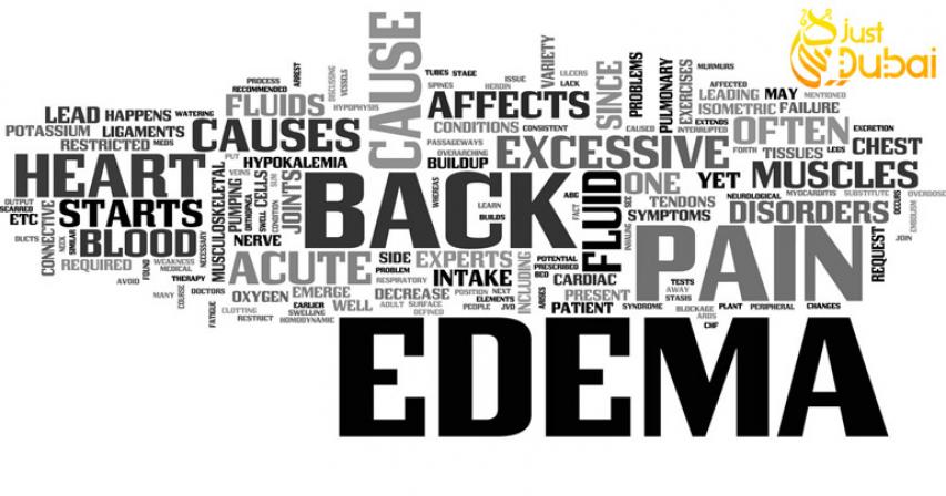 Acute Edema and Back Pain