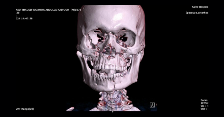 Delivery rider's journey to recovery