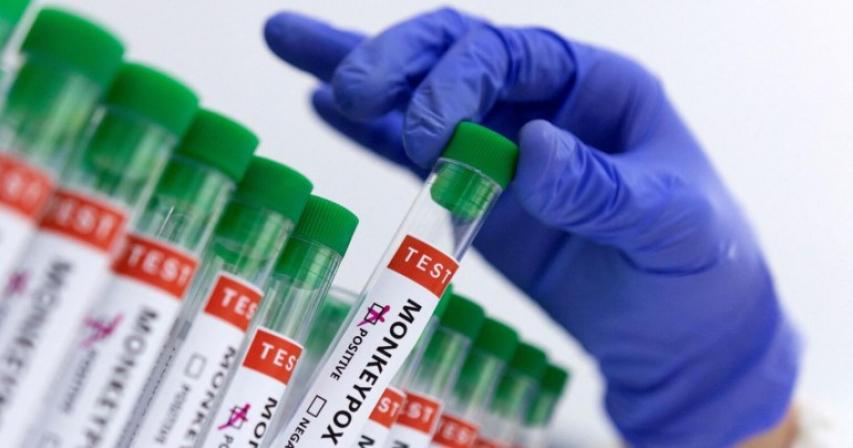 mpox-global-health-emergency-symptoms-spread-prevention-explained