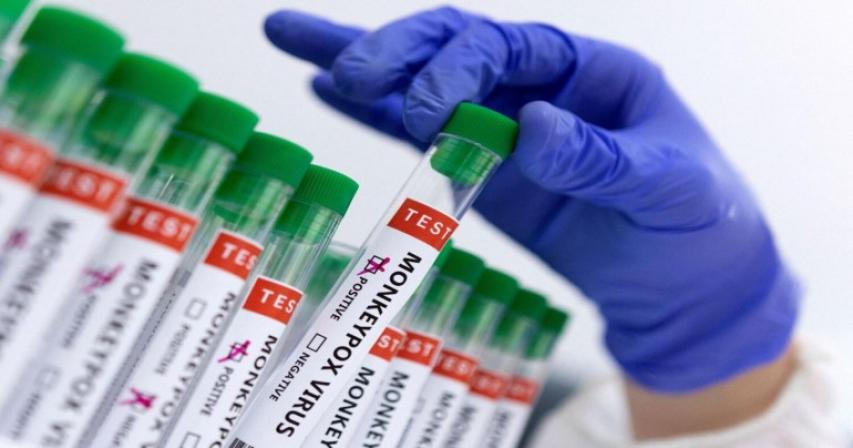 how-abu-dhabi-used-waste-water-samples-from-planes-to-prevent-spread-of-monkeypox-in-uae