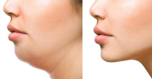 Exercises to Get Rid of Double Chin