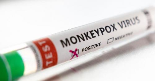 What UAE is doing to track and prevent spread of Monkeypox