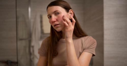 UAE: Itchy during winters? Breakouts, dry skin conditions on the rise