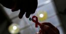 First woman reported cured of HIV after stem cell transplant