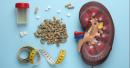 Kidney Stone Prevention: 6 Foods to Limit and What to Eat Instead