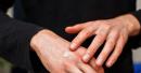 Why Your Skin Feels Dry After Moving to Dubai